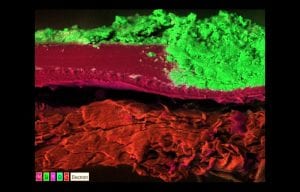 membrane autopsies