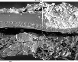 membrane autopsies