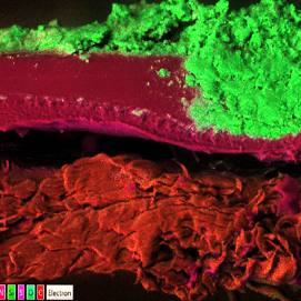 
autopsia de membrana utilizando Superposición Elemental de Imágenes (SEI)