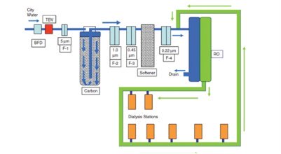 kidney dialysis